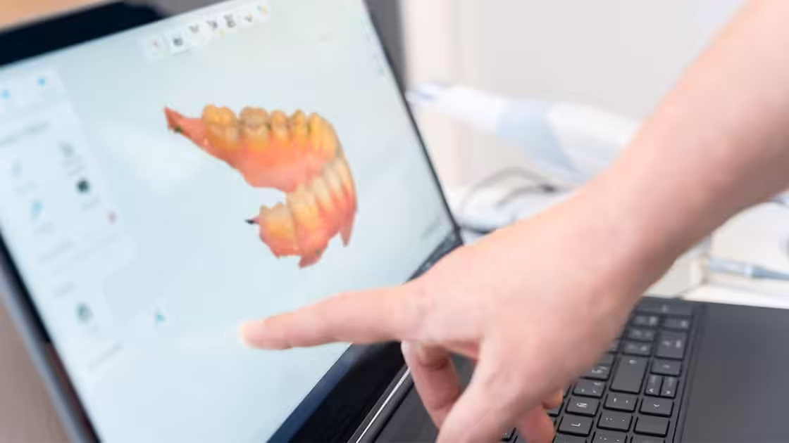 Digital impressions photo